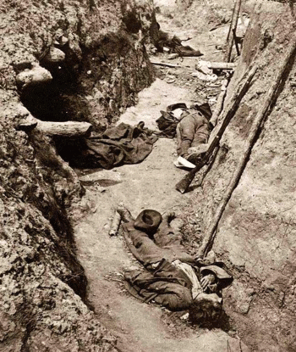 warfare-trench