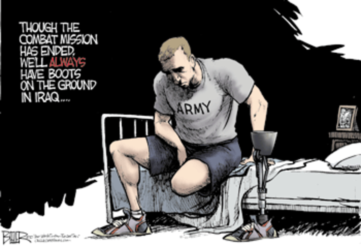iraq war amputee