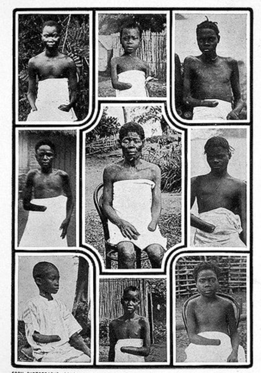 Victims of the Rubber Terror 