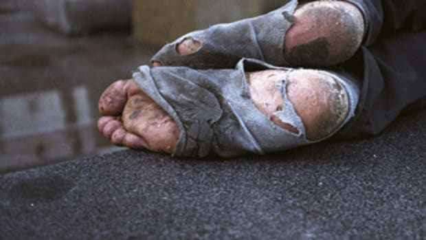homeless feet
