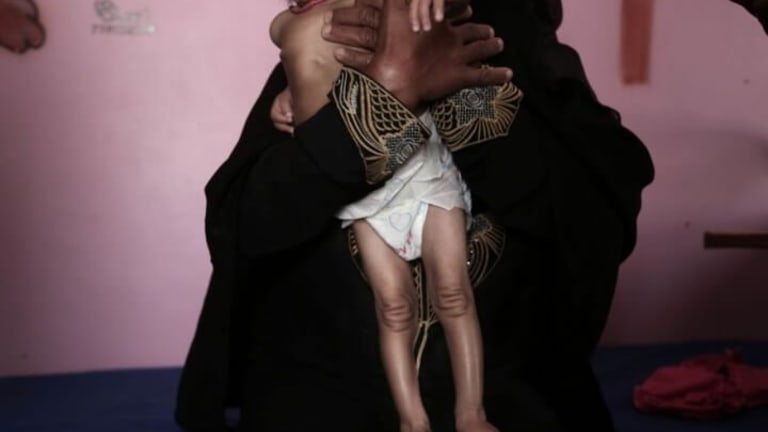 The Long, Brutal U.S. War on Children in the Middle East