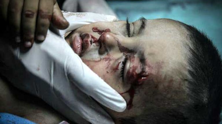 Eye Opening Tweets Directly from the Ground in Gaza