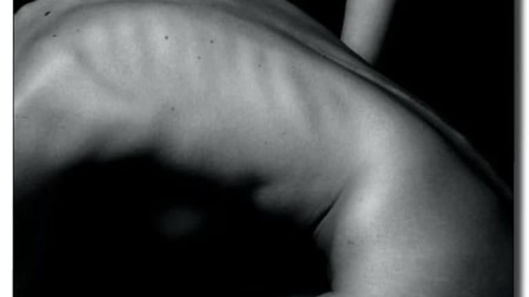 Improve Your Back Health with These 5 Strategies