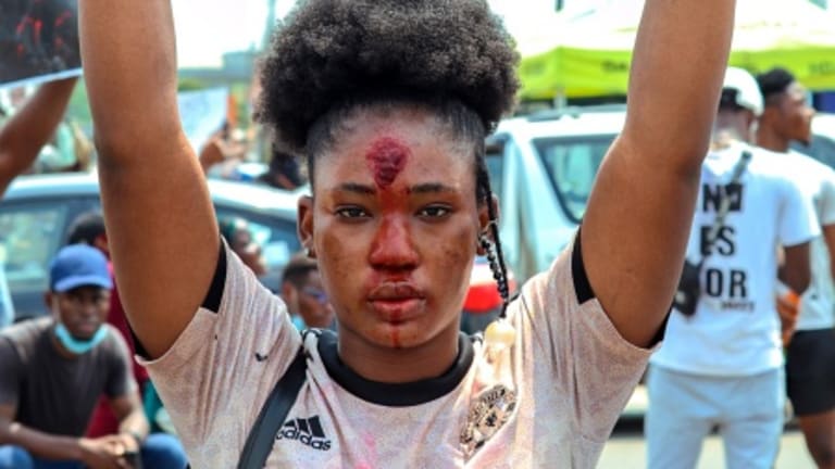 Isn't Freedom From Police Brutality a Human Right?
