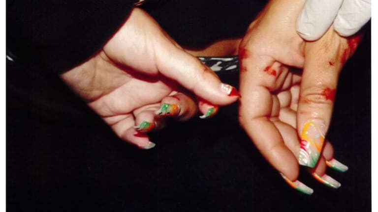 Trial Starts for Woman with Erb’s Palsy Punched in Face Repeatedly by LAPD Officers