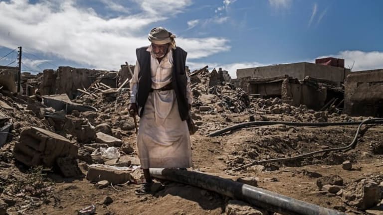 In Yemen, Shocked to His Bones