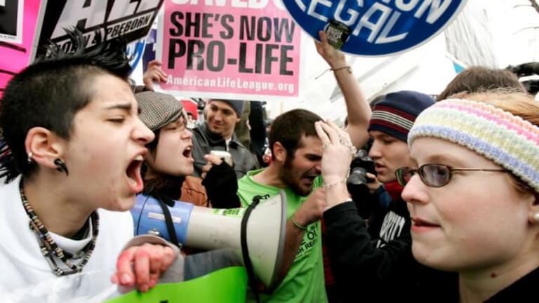 Pro-Life or Anti-Abortion?
