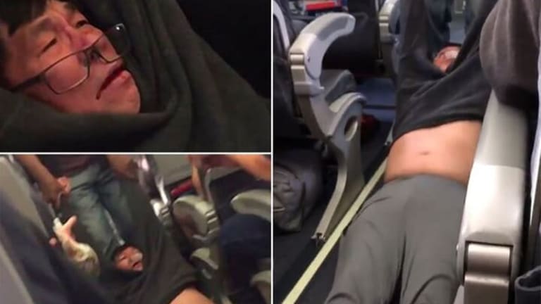 Fly the Friendly Skies of United - Really