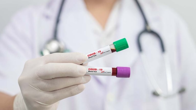 Asymptomatic Health Workers Told to Return to Work