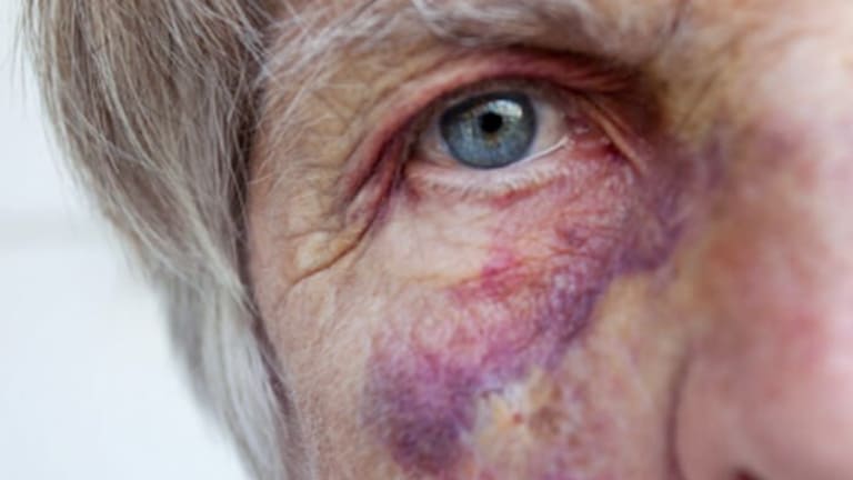 Is Adult Protective Services Protecting Abusers?