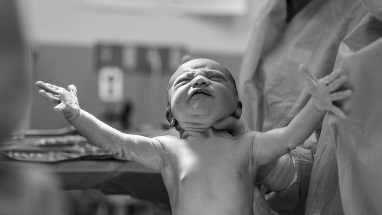 5 Types of Birth Injuries Spurred by Doctors’ Negligence