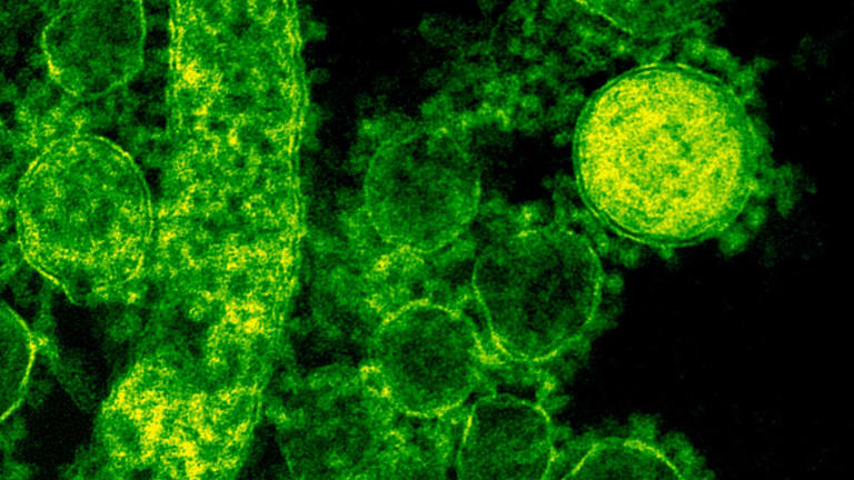 Monkeypox a Black Disease?