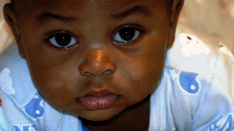 Adopted by a White Family: Too Dark for Blacks