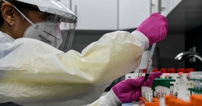 A lab technician sorts blood samples for Covid-19 vaccination study at the Research Centers of America in Hollywood, Florida on August 13, 2020. (Photo: Chandan Khanna/AFP via Getty Images)