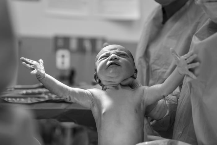Birth Injuries