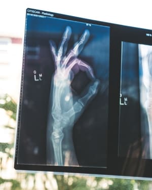 Junk Health Insurance: Time to Take out the Trash