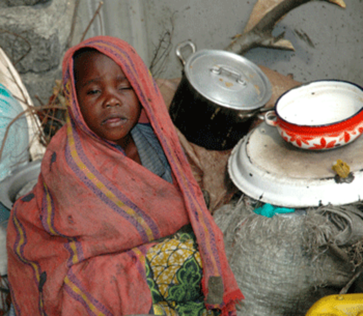 malnourished congolese child