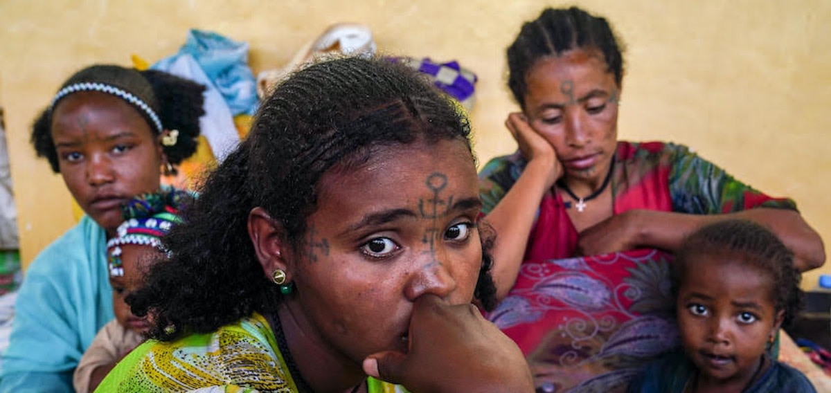 Shell Shocked in Amhara
