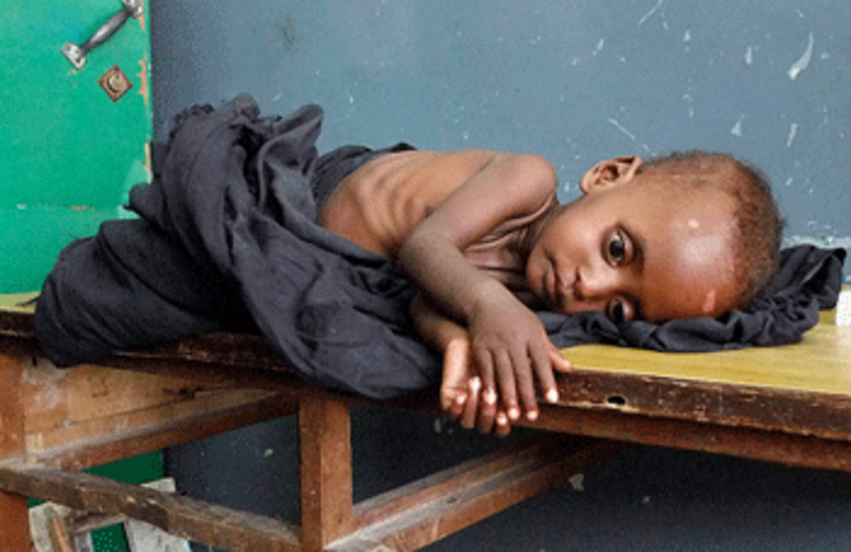 World hunger in east africa