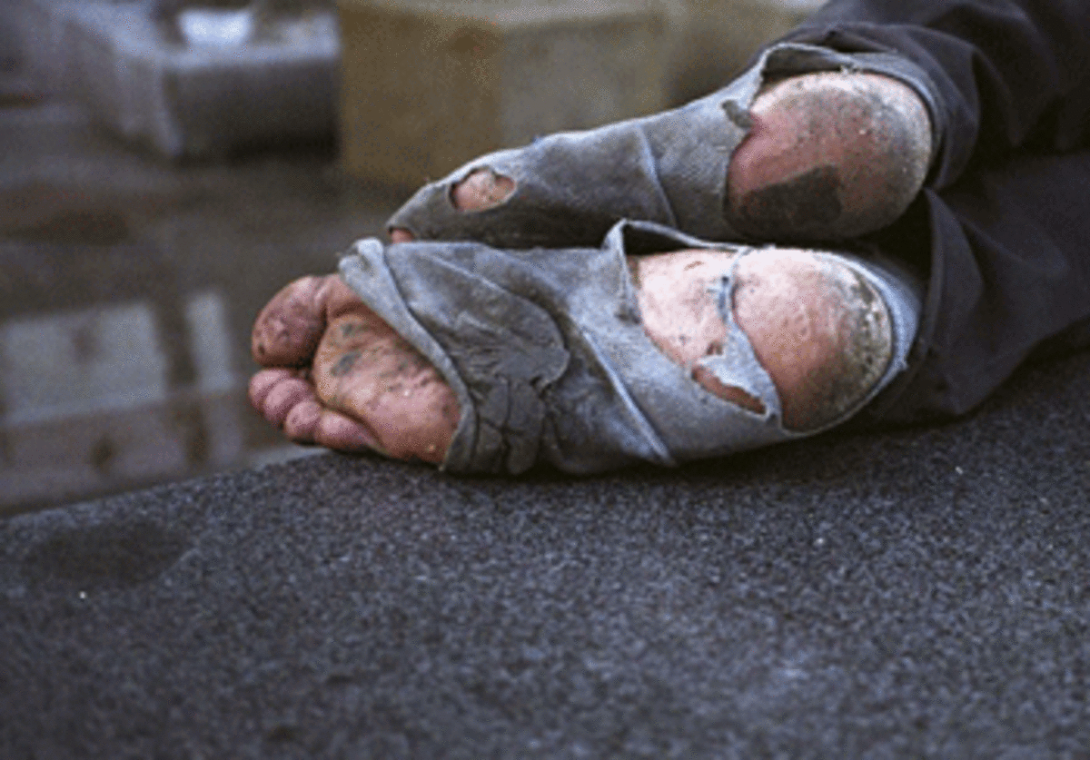 homeless feet
