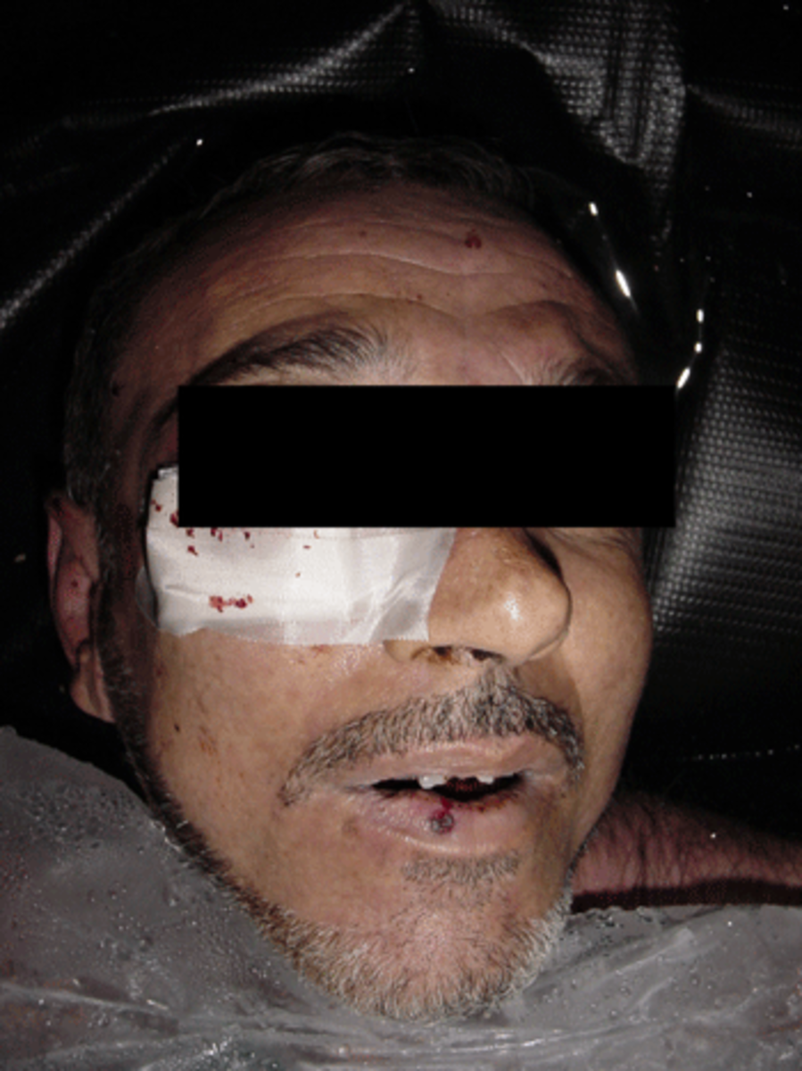 abughraib13 Photo: SBS/Dateline